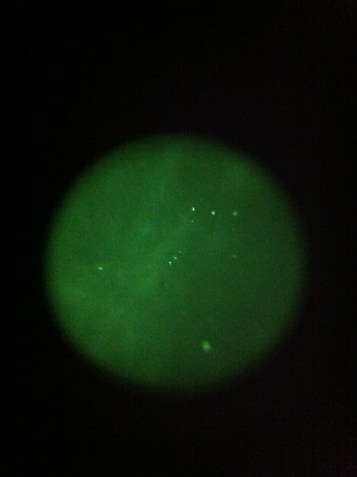 nightscope